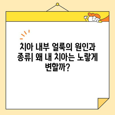 치아 내부 얼룩, 화이트닝으로 말끔하게 제거하는 방법 | 치아 미백, 내부 얼룩 제거, 화이트닝 효과