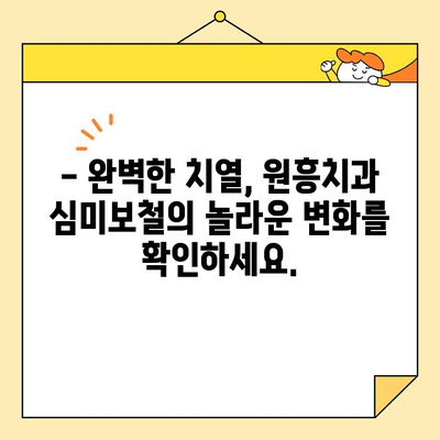 원흥치과의 심미보철, 완벽한 치열을 만나다 | 치아 미백, 라미네이트, 치아교정, 임플란트
